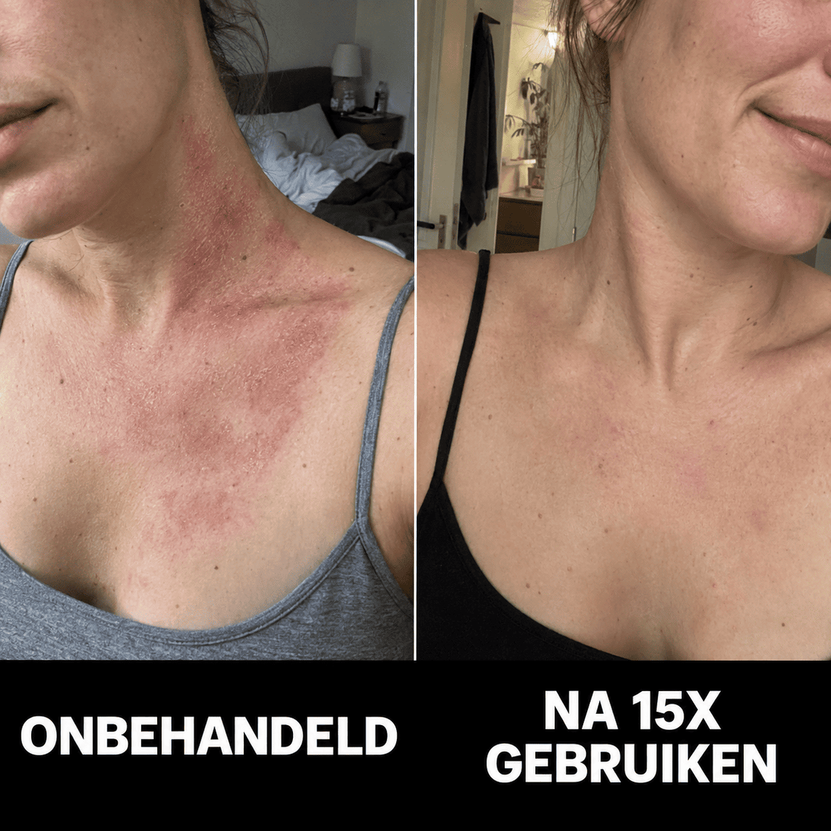 De Complete Huidherstel Kuur